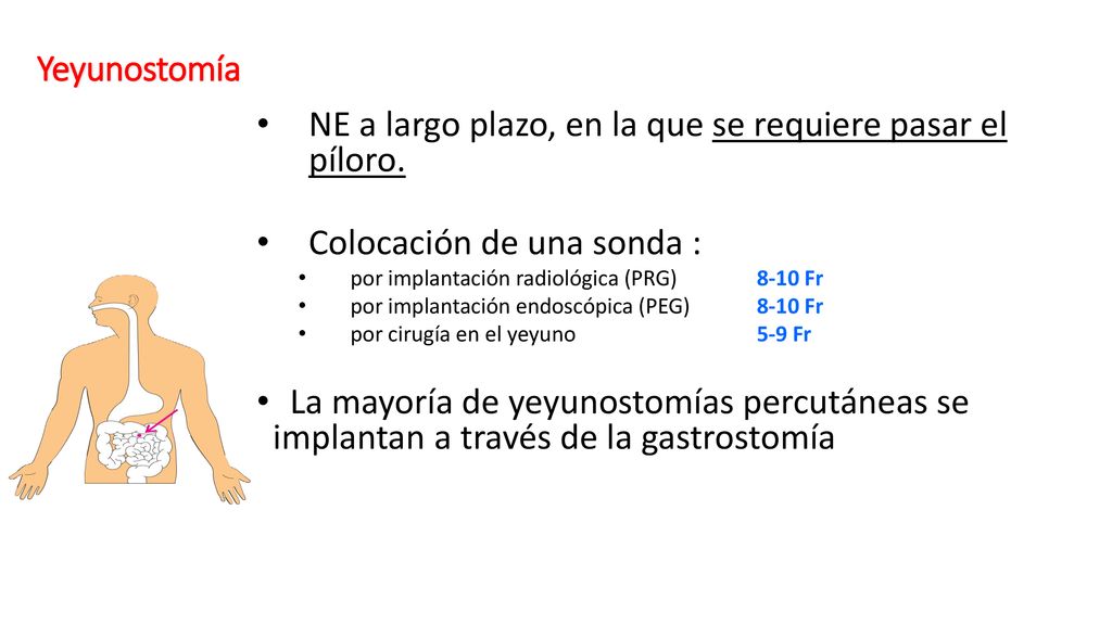 NE a largo plazo, en la que se requiere pasar el píloro.