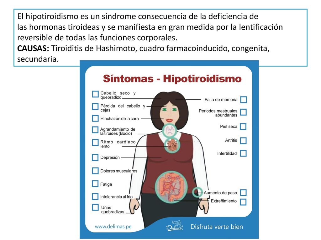 El hipotiroidismo es un síndrome consecuencia de la deficiencia de
