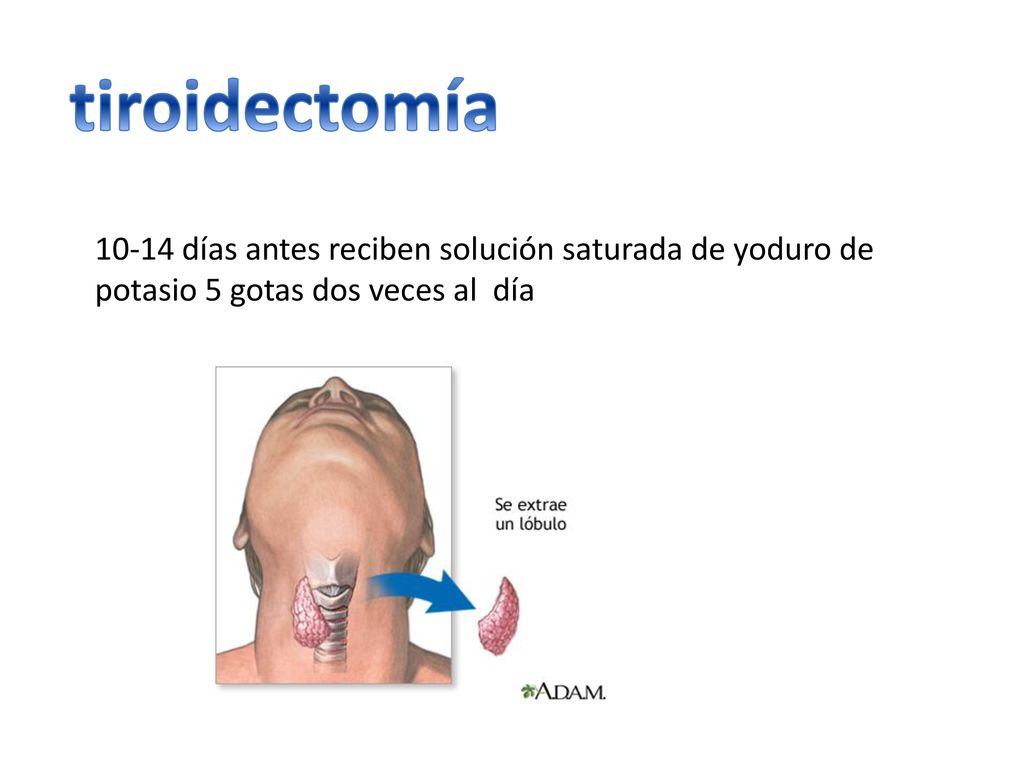 tiroidectomía días antes reciben solución saturada de yoduro de potasio 5 gotas dos veces al día.