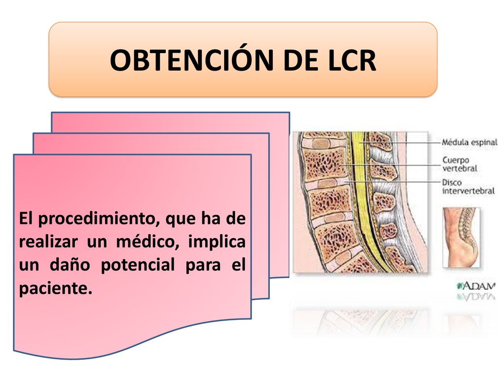 OBTENCIÓN DE LCR El procedimiento, que ha de realizar un médico, implica un daño potencial para el paciente.
