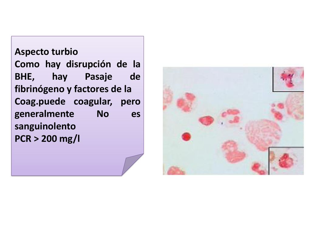 Aspecto turbio Como hay disrupción de la BHE, hay Pasaje de fibrinógeno y factores de la. Coag.puede coagular, pero generalmente No es sanguinolento.