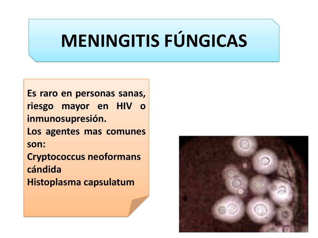 MENINGITIS FÚNGICAS Es raro en personas sanas, riesgo mayor en HIV o inmunosupresión. Los agentes mas comunes son: