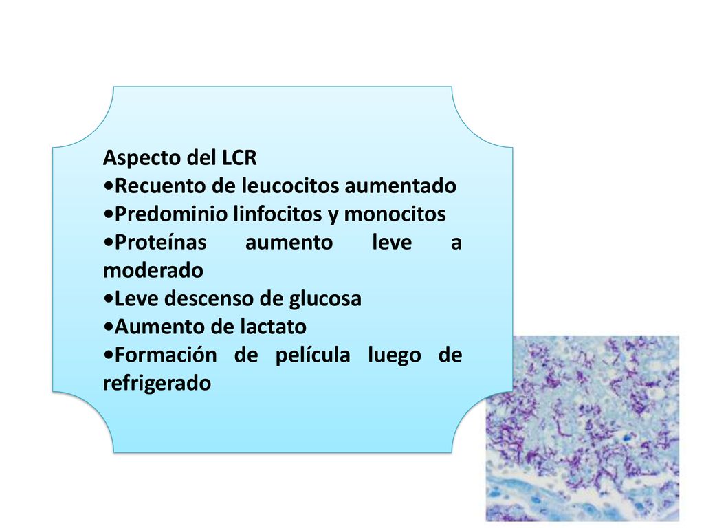 Aspecto del LCR •Recuento de leucocitos aumentado. •Predominio linfocitos y monocitos. •Proteínas aumento leve a moderado.