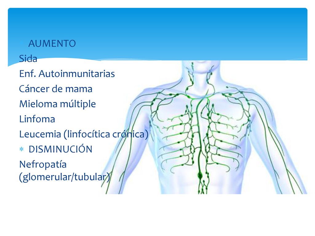 AUMENTO Sida. Enf. Autoinmunitarias. Cáncer de mama. Mieloma múltiple. Linfoma. Leucemia (linfocítica crónica)