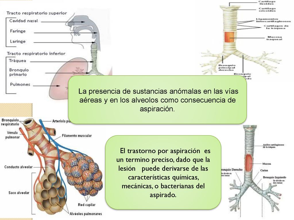 La presencia de sustancias anómalas en las vías aéreas y en los alveolos como consecuencia de aspiración.