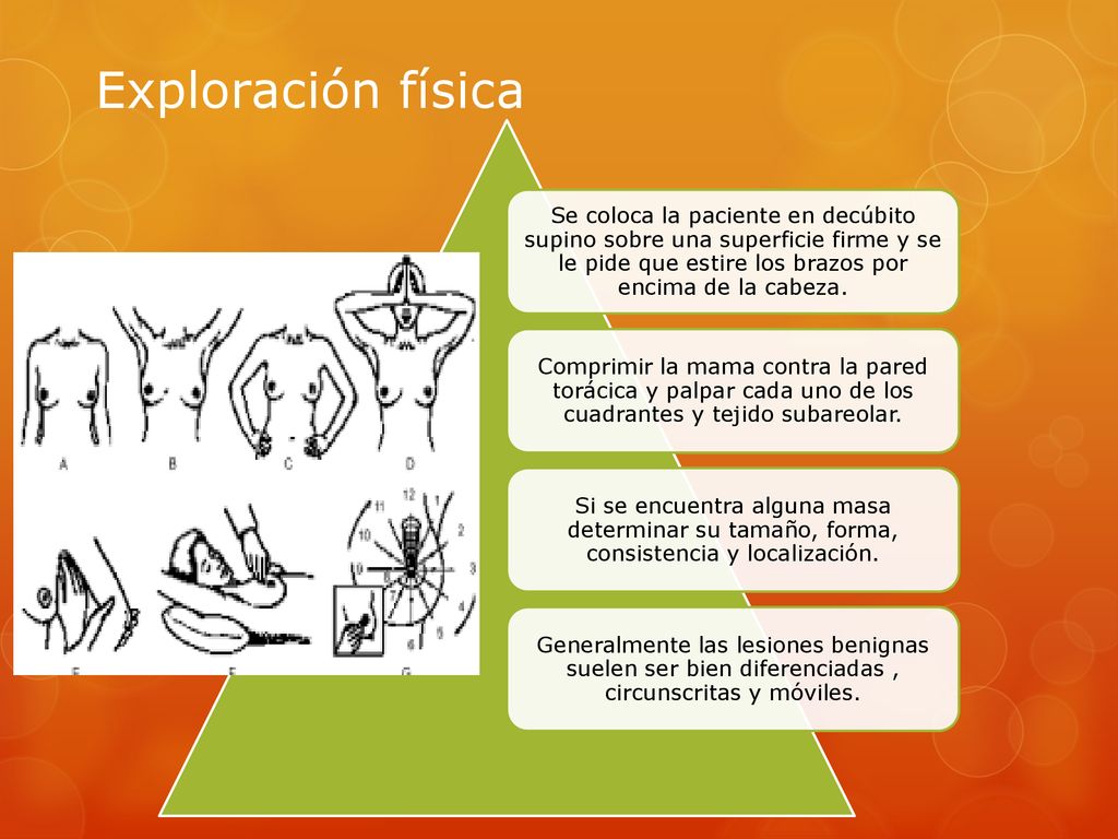 Exploración física Se coloca la paciente en decúbito supino sobre una superficie firme y se le pide que estire los brazos por encima de la cabeza.
