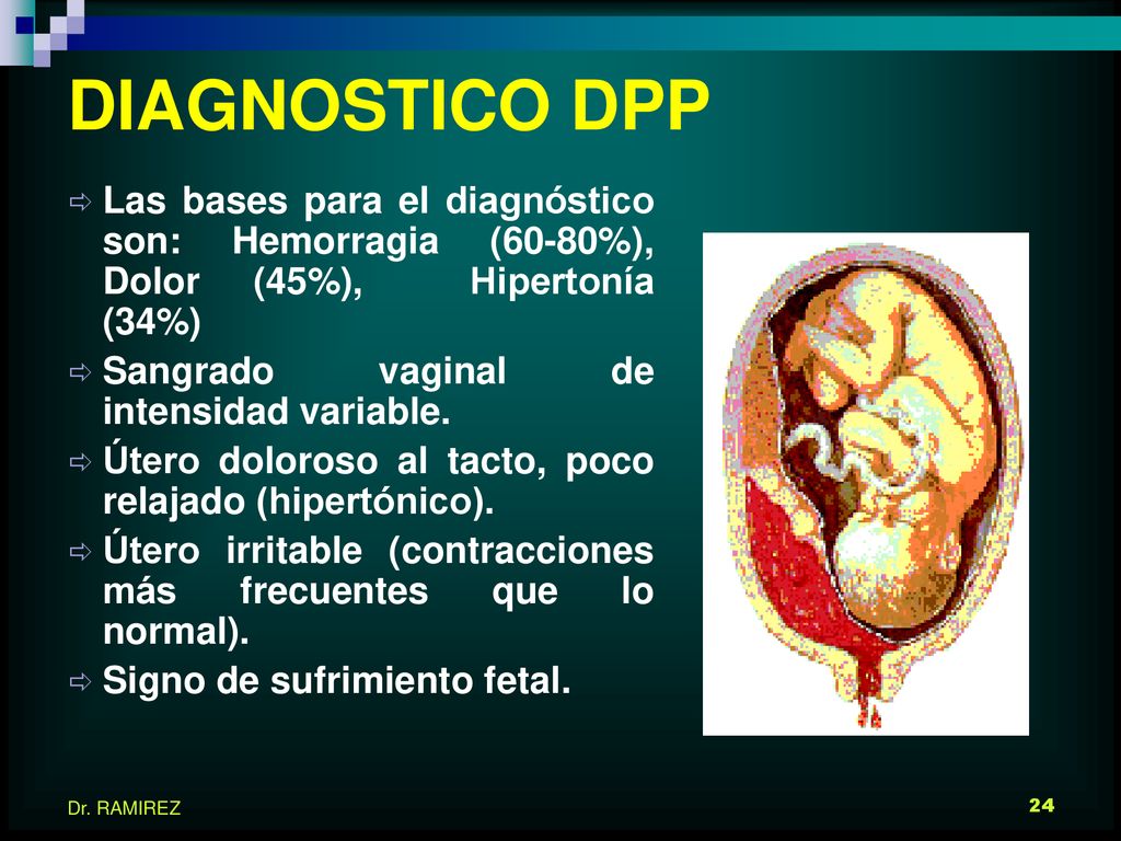 DIAGNOSTICO DPP Las bases para el diagnóstico son: Hemorragia (60-80%), Dolor (45%), Hipertonía (34%)