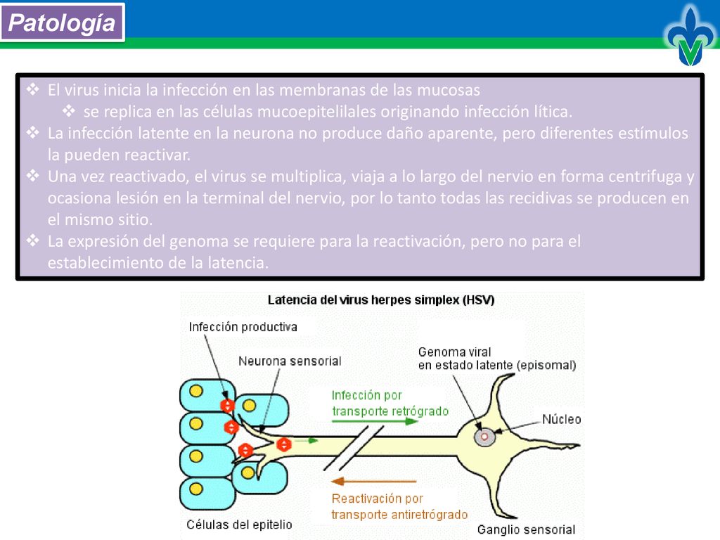 Patología El virus inicia la infección en las membranas de las mucosas