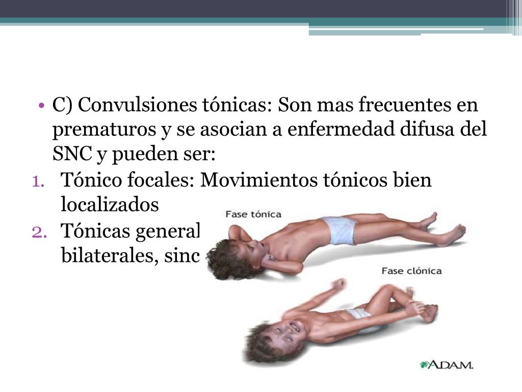 C) Convulsiones tónicas: Son mas frecuentes en prematuros y se asocian a enfermedad difusa del SNC y pueden ser: