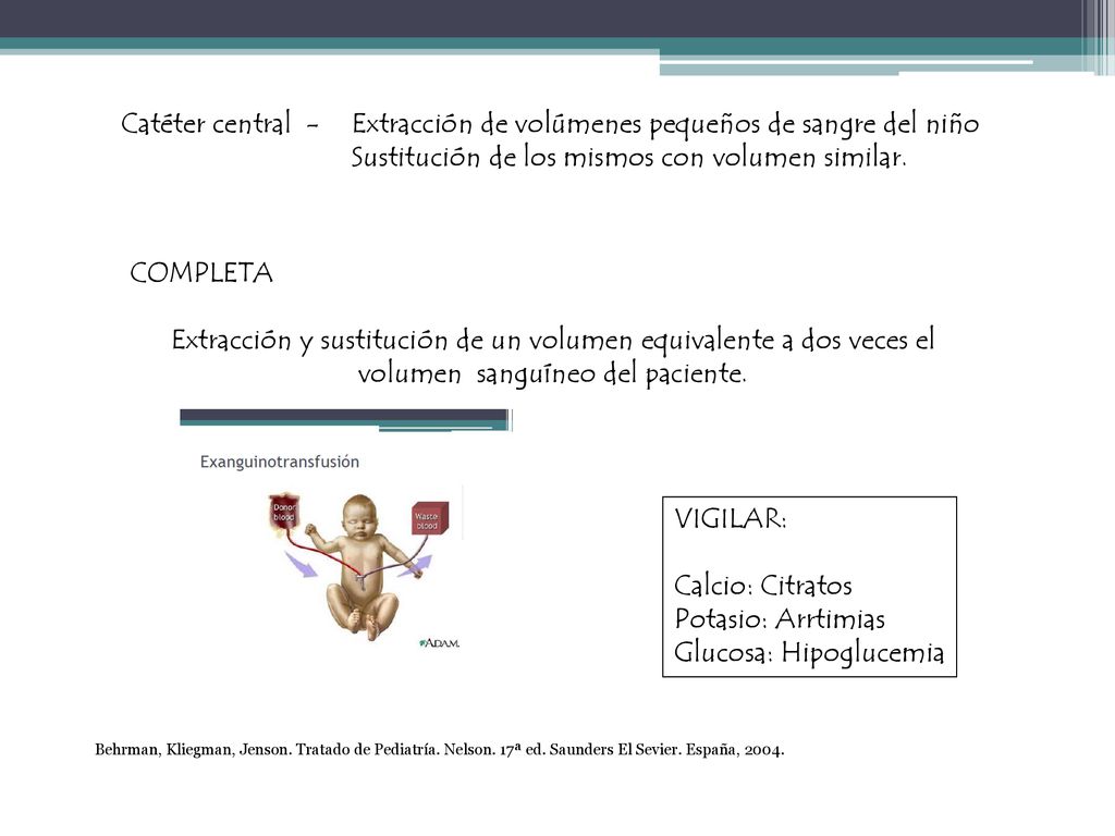 Catéter central - Extracción de volúmenes pequeños de sangre del niño