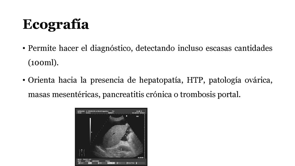 Ecografía Permite hacer el diagnóstico, detectando incluso escasas cantidades (100ml).