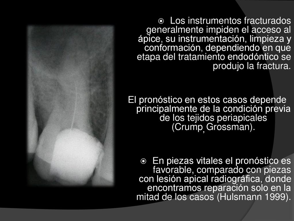 Los instrumentos fracturados generalmente impiden el acceso al ápice, su instrumentación, limpieza y conformación, dependiendo en que etapa del tratamiento endodóntico se produjo la fractura.