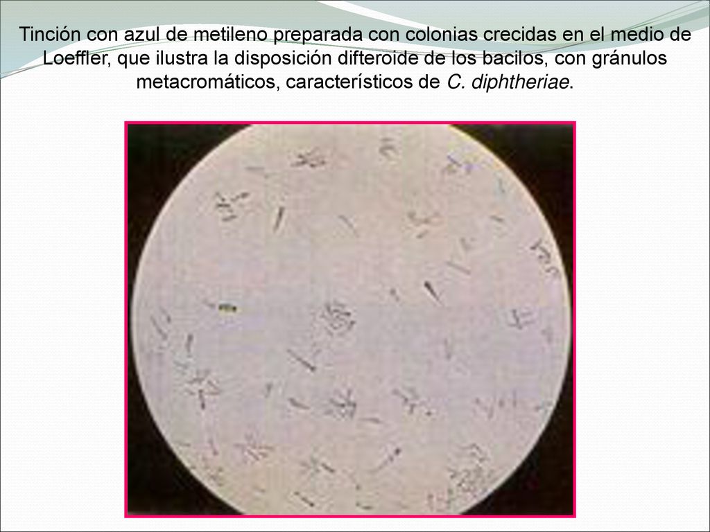 Tinción con azul de metileno preparada con colonias crecidas en el medio de Loeffler, que ilustra la disposición difteroide de los bacilos, con gránulos metacromáticos, característicos de C.