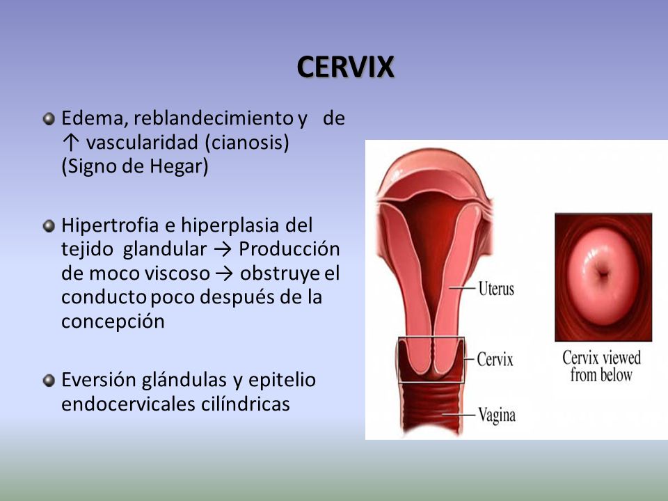 CERVIX Edema, reblandecimiento y de ↑ vascularidad (cianosis) (Signo de Hegar)