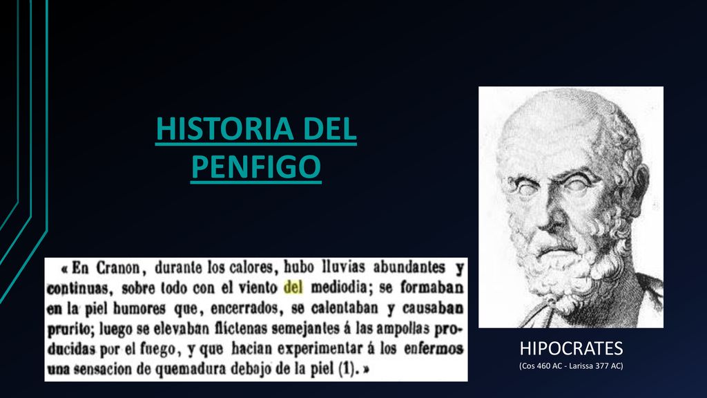 HISTORIA DEL PENFIGO HIPOCRATES (Cos 460 AC - Larissa 377 AC)