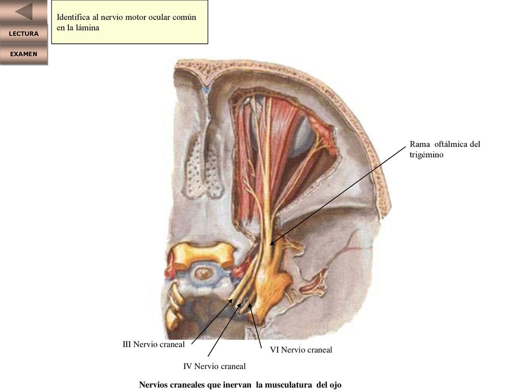 Identifica al nervio motor ocular común en la lámina