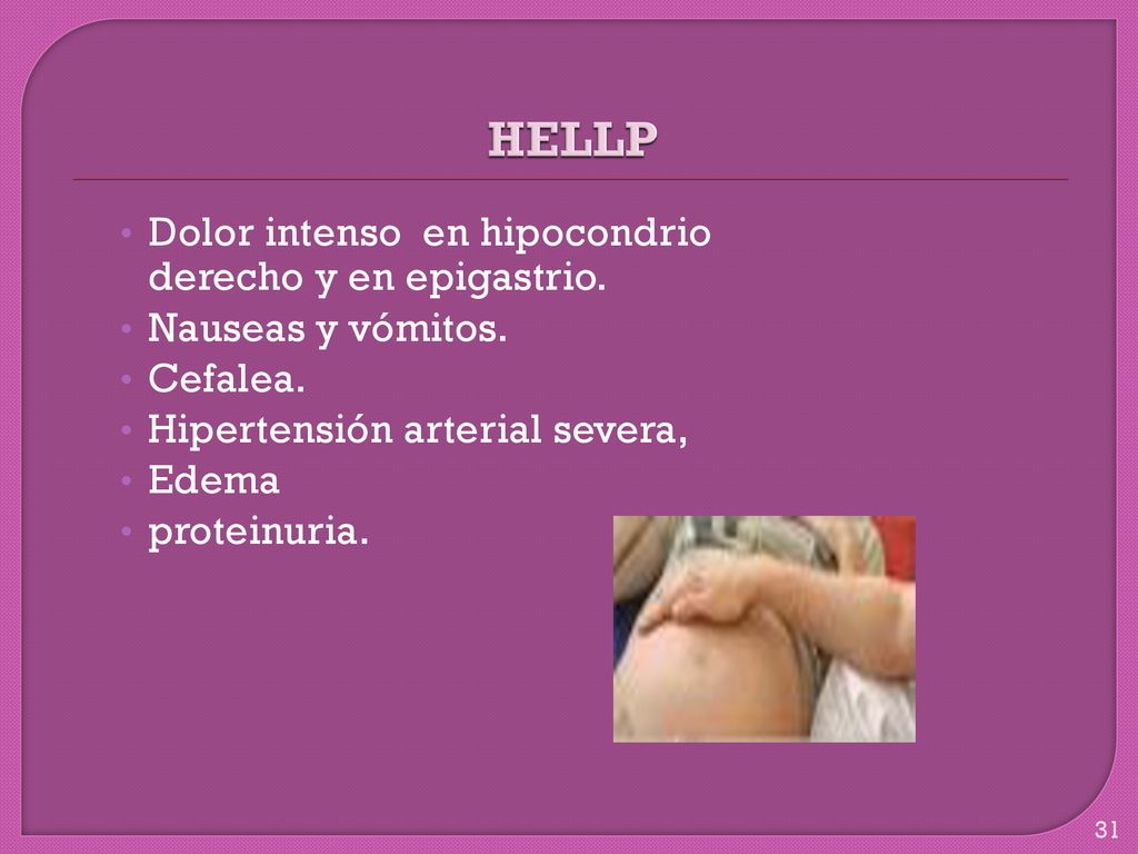 HELLP Dolor intenso en hipocondrio derecho y en epigastrio.