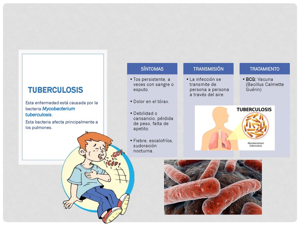 TUBERCULOSIS SÍNTOMAS Tos persistente, a veces con sangre o esputo.