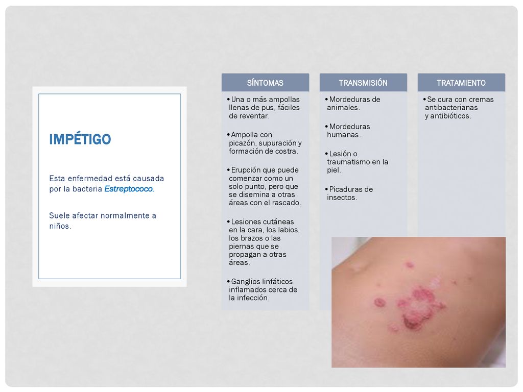 Impétigo Esta enfermedad está causada por la bacteria Estreptococo.