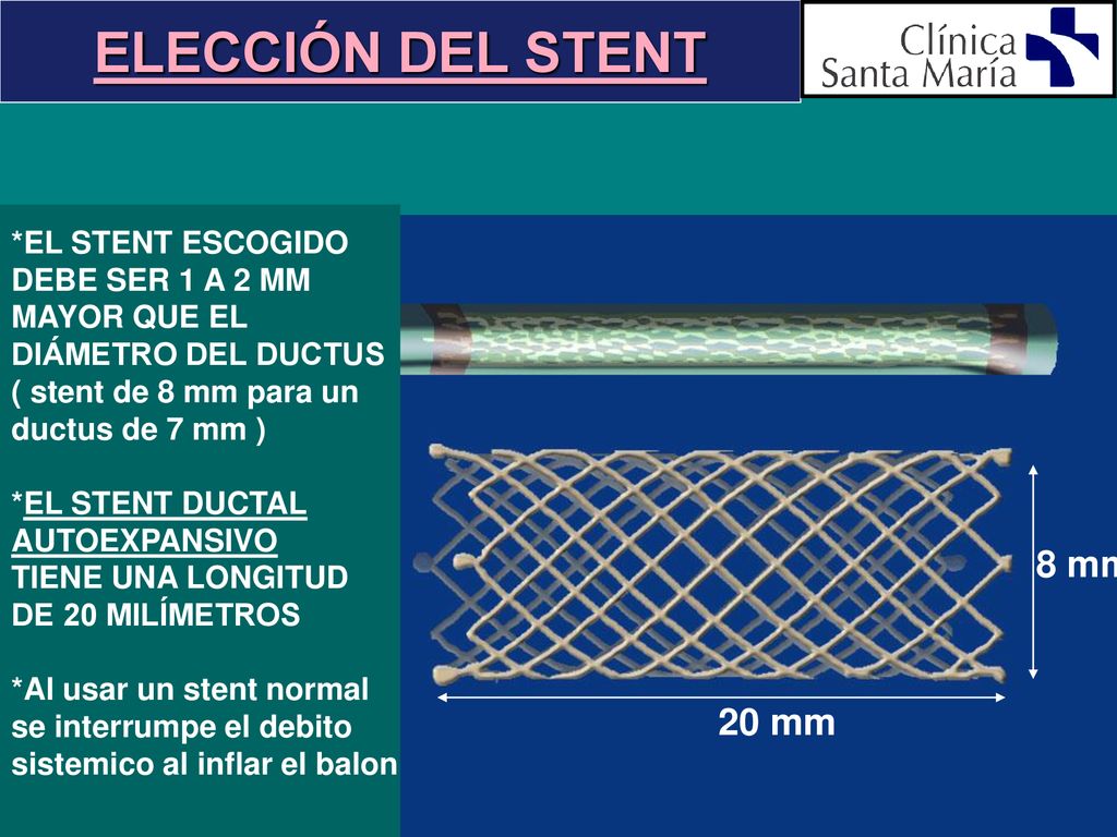 ELECCIÓN DEL STENT 8 mm 20 mm *EL STENT ESCOGIDO DEBE SER 1 A 2 MM