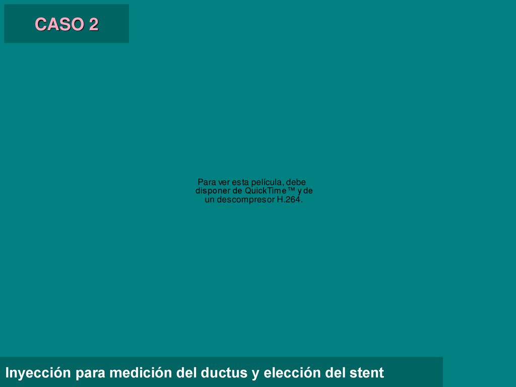 CASO 2 Inyección para medición del ductus y elección del stent