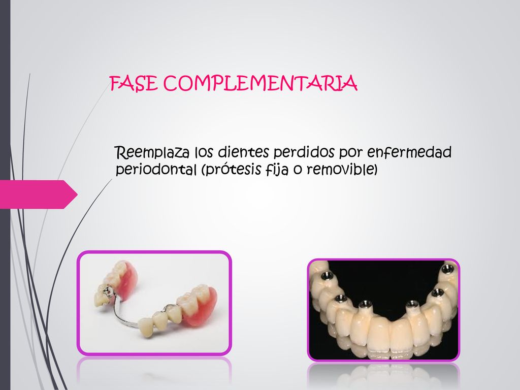 FASE COMPLEMENTARIA Reemplaza los dientes perdidos por enfermedad periodontal (prótesis fija o removible)