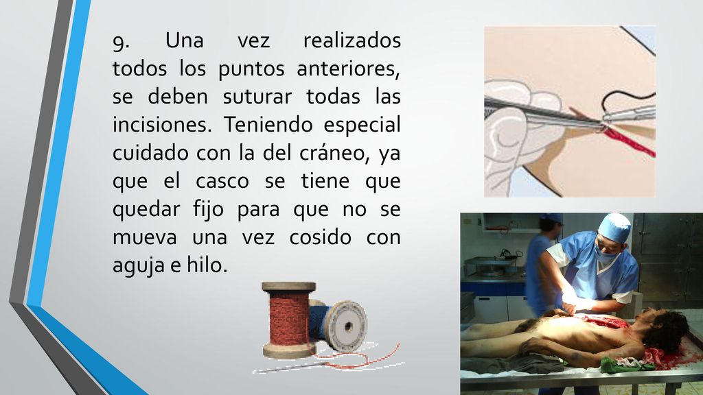 9. Una vez realizados todos los puntos anteriores, se deben suturar todas las incisiones.