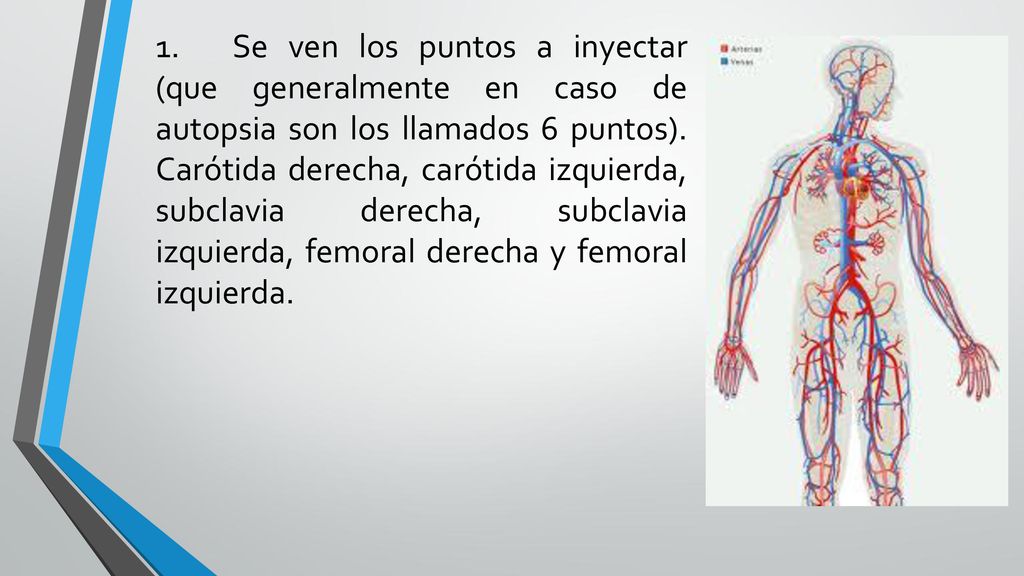 1. Se ven los puntos a inyectar (que generalmente en caso de autopsia son los llamados 6 puntos).