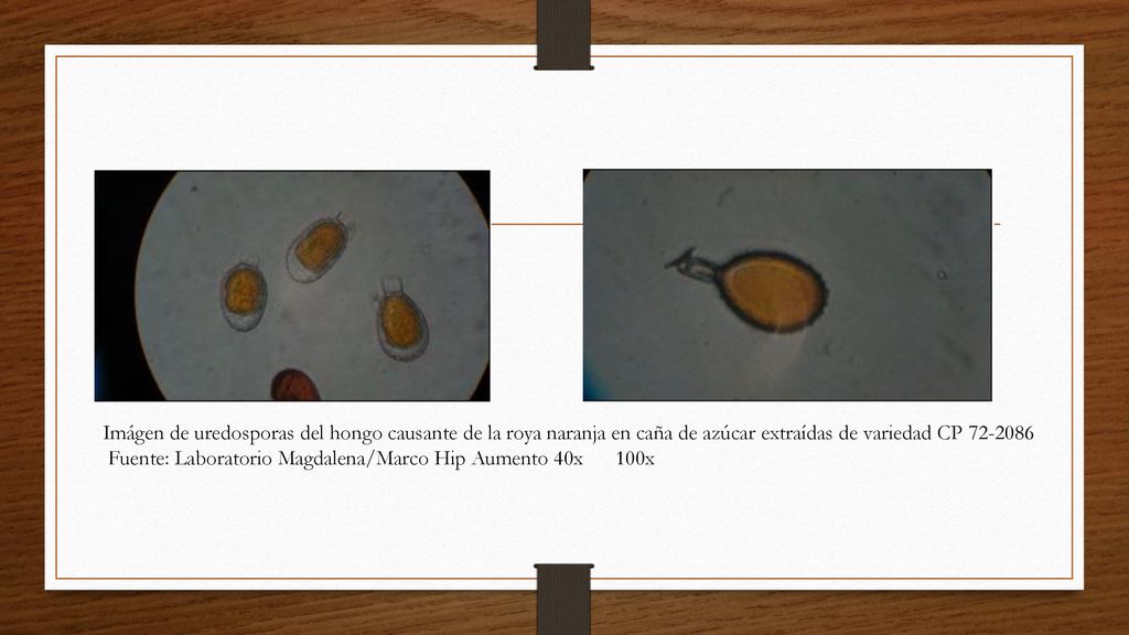 Imágen de uredosporas del hongo causante de la roya naranja en caña de azúcar extraídas de variedad CP