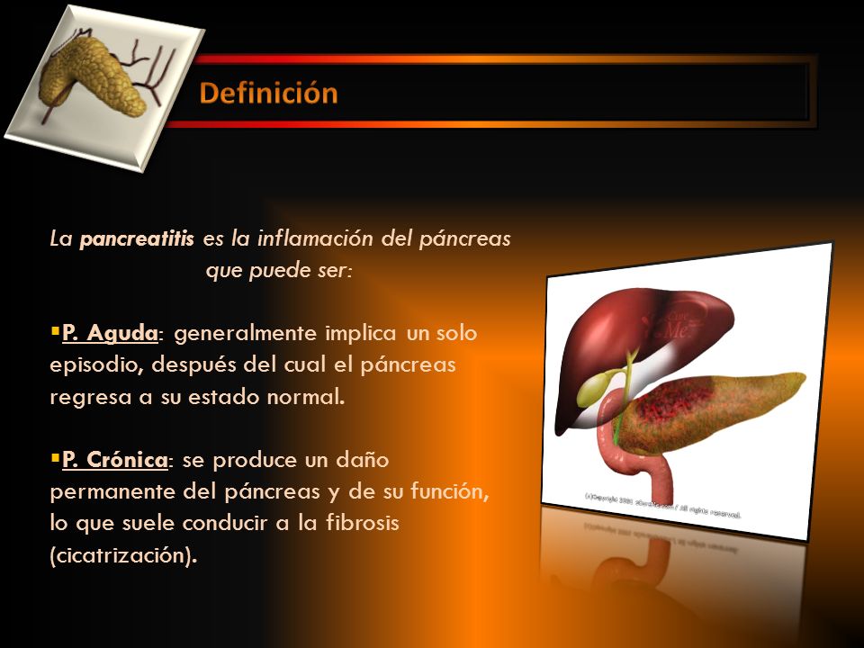 La pancreatitis es la inflamación del páncreas que puede ser: