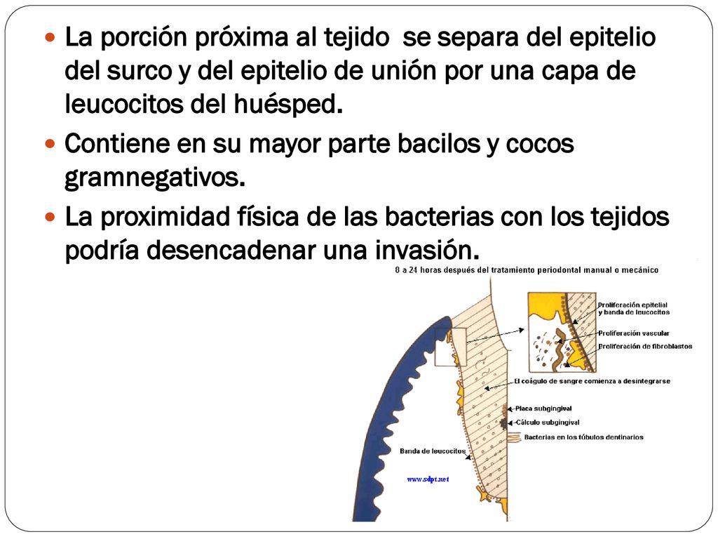 La porción próxima al tejido se separa del epitelio del surco y del epitelio de unión por una capa de leucocitos del huésped.