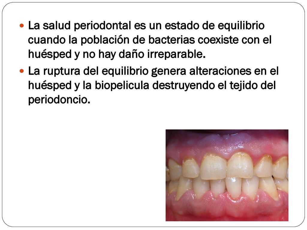 La salud periodontal es un estado de equilibrio cuando la población de bacterias coexiste con el huésped y no hay daño irreparable.