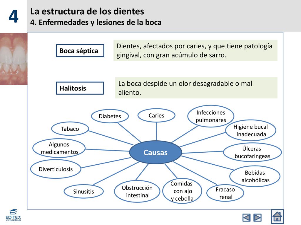 La estructura de los dientes 4. Enfermedades y lesiones de la boca