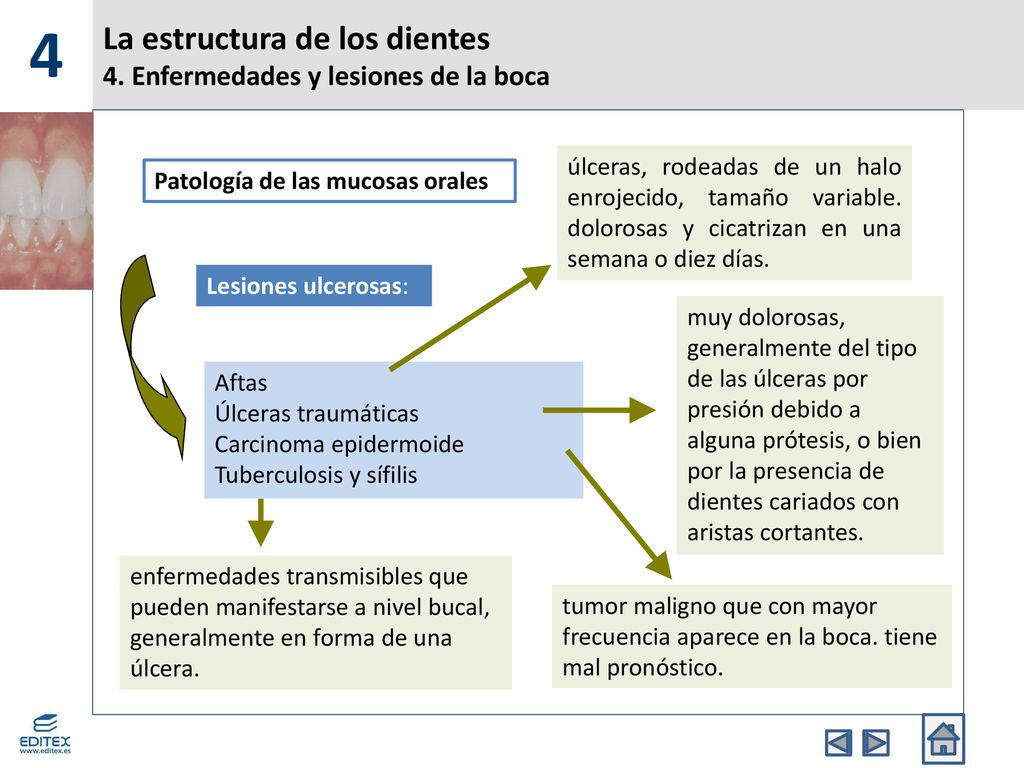 La estructura de los dientes 4. Enfermedades y lesiones de la boca