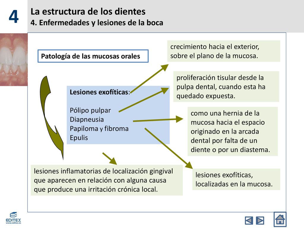 La estructura de los dientes 4. Enfermedades y lesiones de la boca