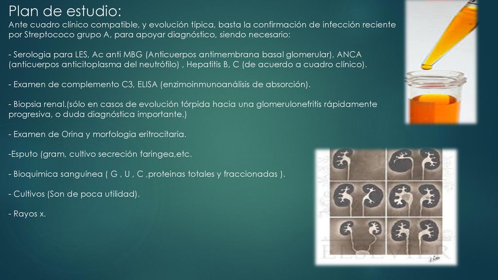 Plan de estudio: Ante cuadro clínico compatible, y evolución típica, basta la confirmación de infección reciente por Streptococo grupo A, para apoyar diagnóstico, siendo necesario: - Serologia para LES, Ac anti MBG (Anticuerpos antimembrana basal glomerular), ANCA (anticuerpos anticitoplasma del neutrófilo) , Hepatitis B, C (de acuerdo a cuadro clínico).