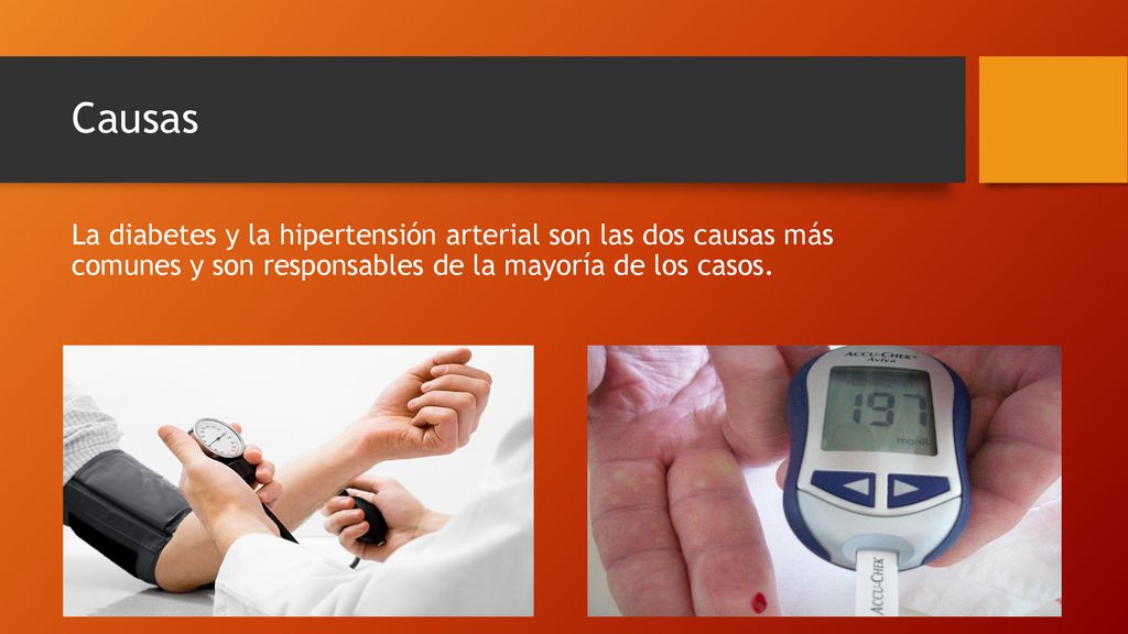 Causas La diabetes y la hipertensión arterial son las dos causas más comunes y son responsables de la mayoría de los casos.