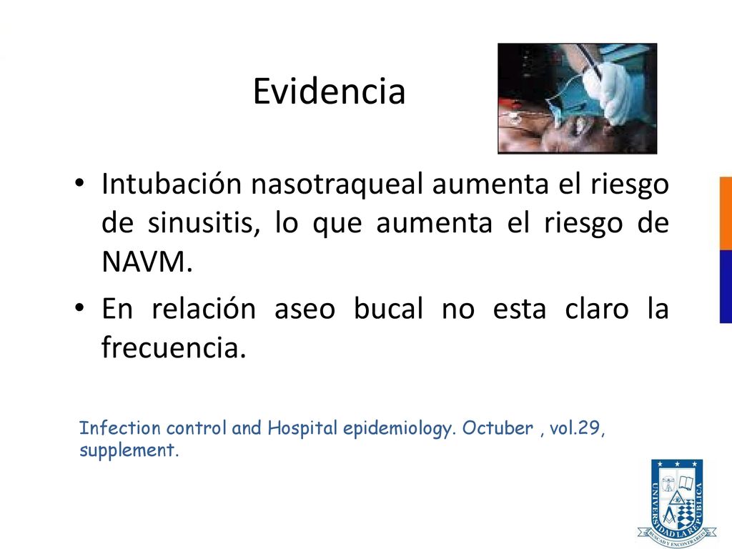 Evidencia Intubación nasotraqueal aumenta el riesgo de sinusitis, lo que aumenta el riesgo de NAVM.