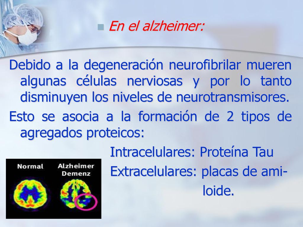 En el alzheimer: Debido a la degeneración neurofibrilar mueren algunas células nerviosas y por lo tanto disminuyen los niveles de neurotransmisores.