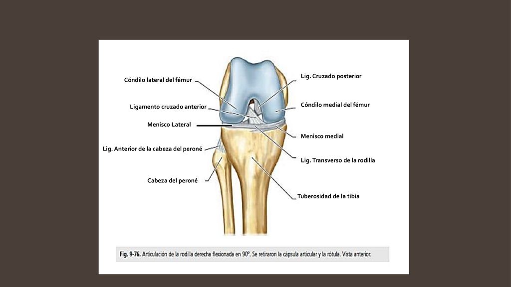 Lig. Cruzado posterior Cóndilo lateral del fémur. Ligamento cruzado anterior. Cóndilo medial del fémur.