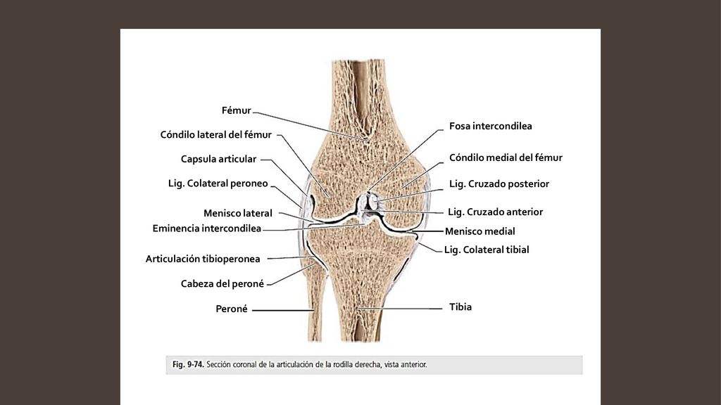 Fémur Fosa intercondilea. Cóndilo lateral del fémur. Capsula articular. Cóndilo medial del fémur.