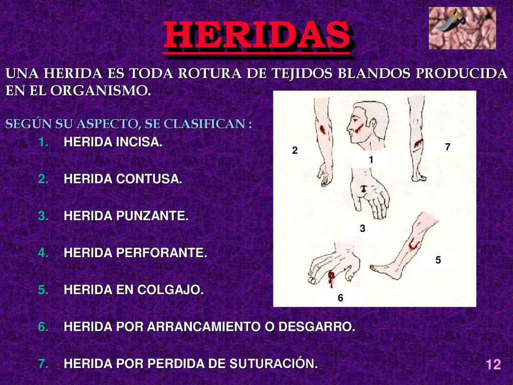 HERIDAS UNA HERIDA ES TODA ROTURA DE TEJIDOS BLANDOS PRODUCIDA EN EL ORGANISMO. SEGÚN SU ASPECTO, SE CLASIFICAN :