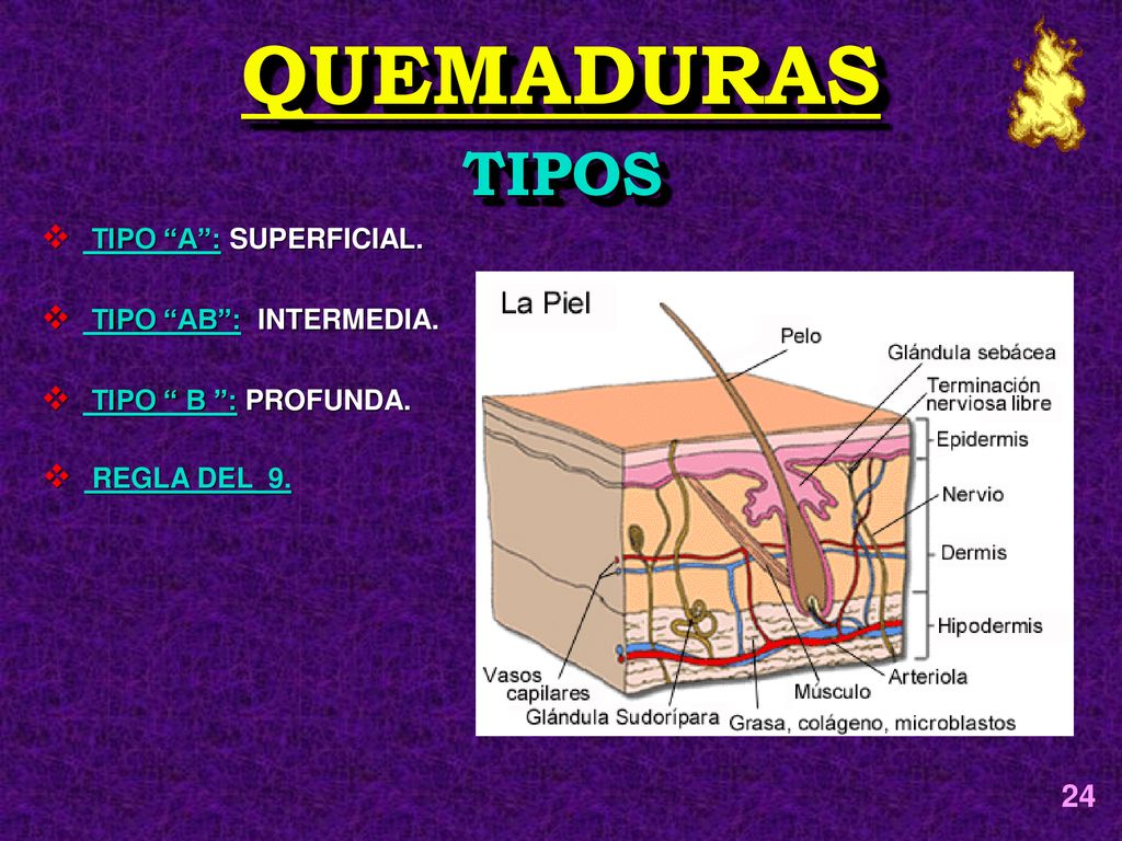 QUEMADURAS TIPOS 24 TIPO A : SUPERFICIAL. TIPO AB : INTERMEDIA.