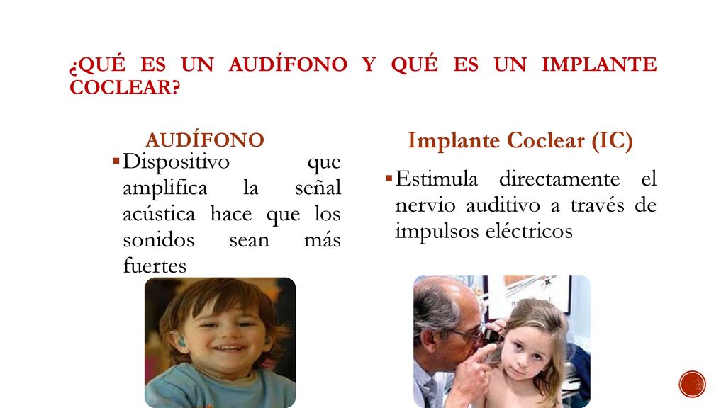 ¿QUÉ ES UN AUDÍFONO Y QUÉ ES UN IMPLANTE COCLEAR