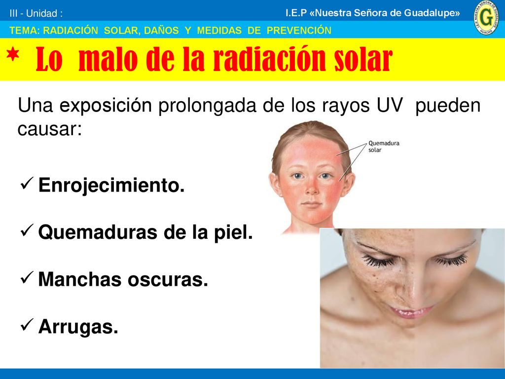 III - Unidad : TEMA: RADIACIÓN SOLAR, DAÑOS Y MEDIDAS DE PREVENCIÓN