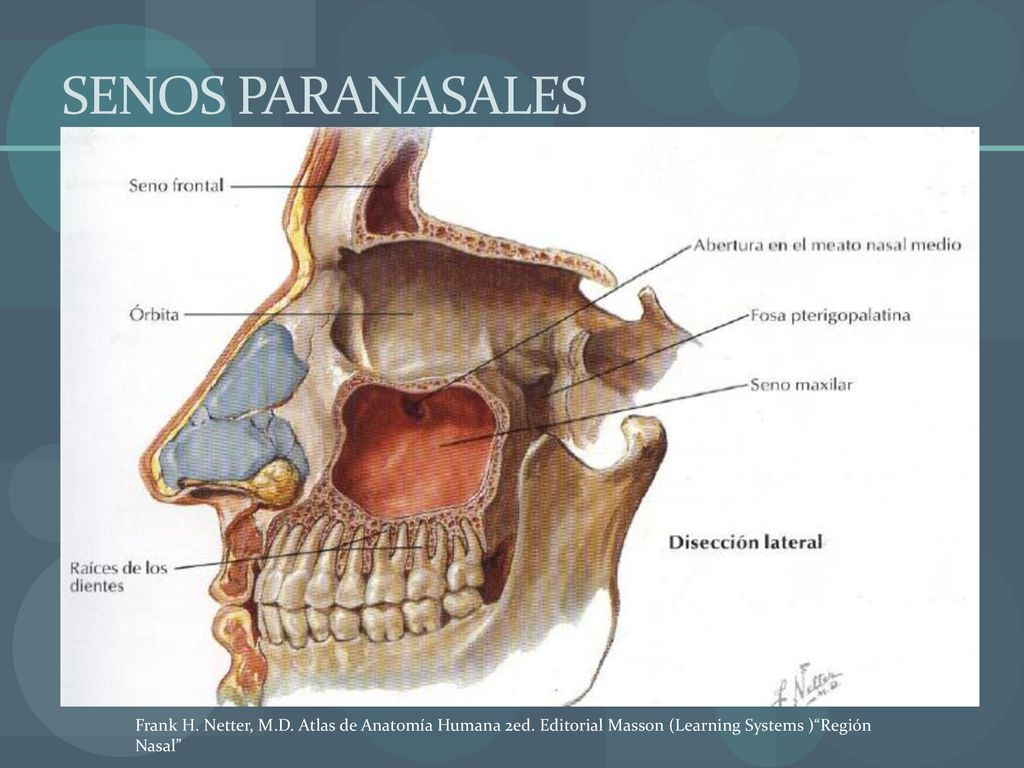 SENOS PARANASALES Frank H. Netter, M.D. Atlas de Anatomía Humana 2ed.
