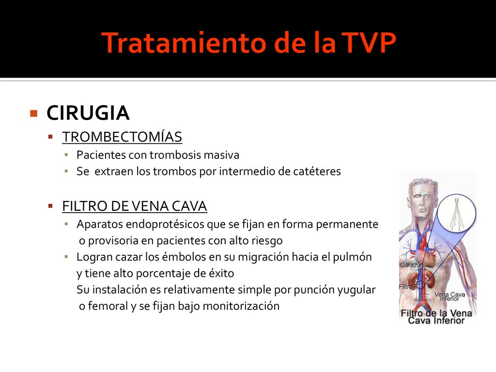 Tratamiento de la TVP CIRUGIA TROMBECTOMÍAS FILTRO DE VENA CAVA