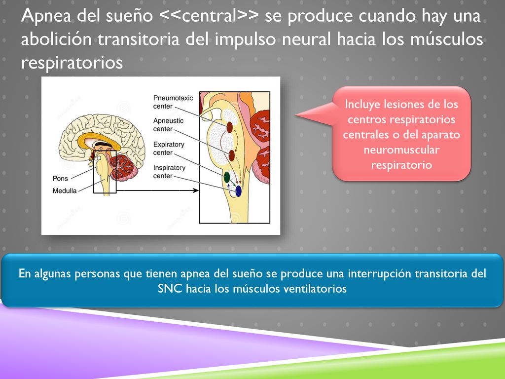 Apnea del sueño <<central>> se produce cuando hay una abolición transitoria del impulso neural hacia los músculos respiratorios