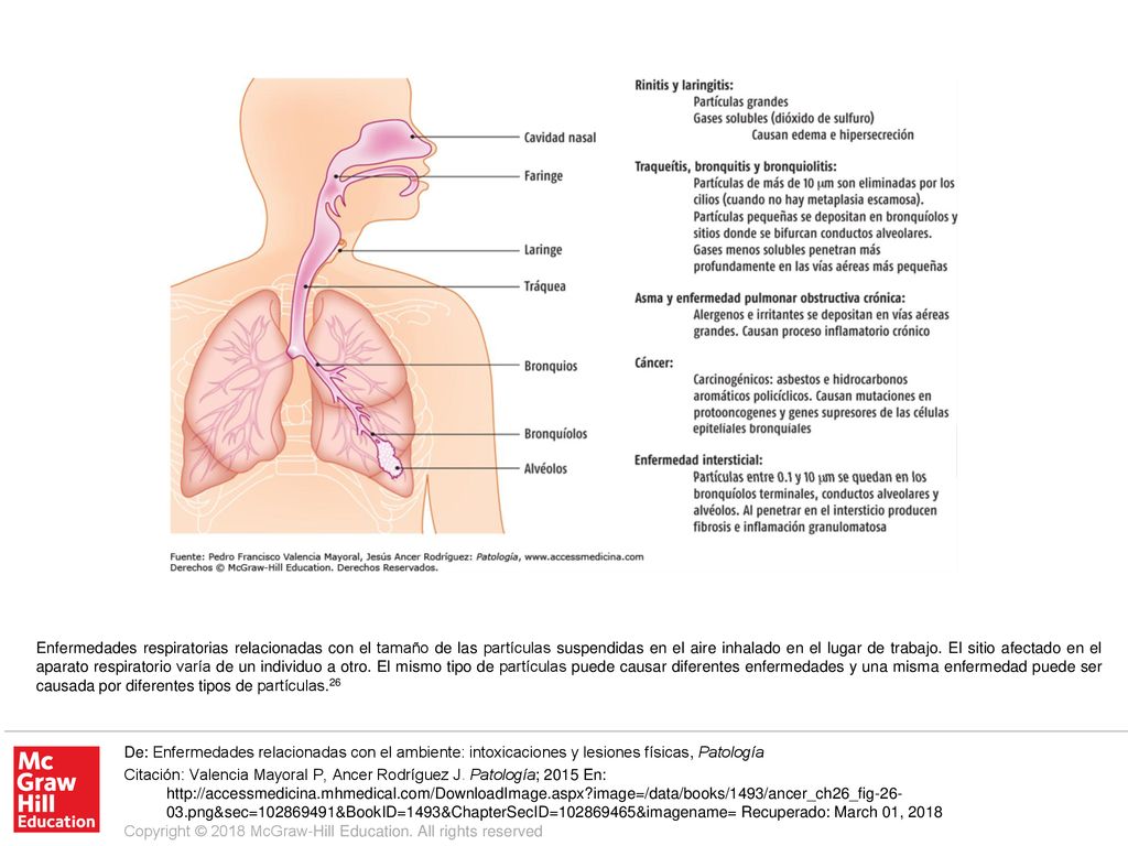 Enfermedades respiratorias relacionadas con el tamaño de las partículas suspendidas en el aire inhalado en el lugar de trabajo. El sitio afectado en el aparato respiratorio varía de un individuo a otro. El mismo tipo de partículas puede causar diferentes enfermedades y una misma enfermedad puede ser causada por diferentes tipos de partículas.26