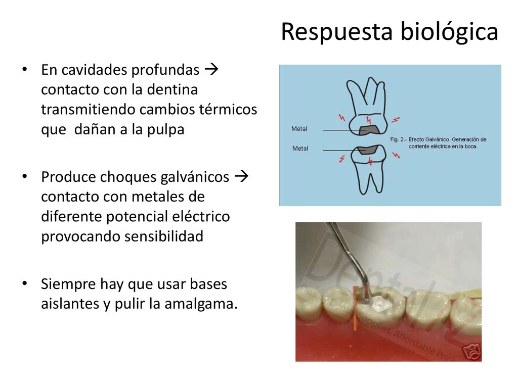 Respuesta biológica En cavidades profundas  contacto con la dentina transmitiendo cambios térmicos que dañan a la pulpa.